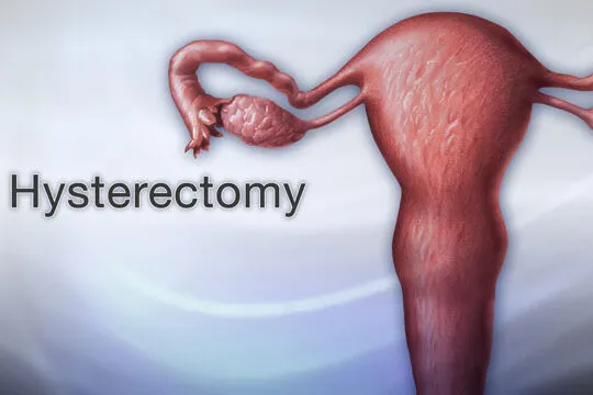 Uterus Removal