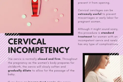 Cervical Cerclage