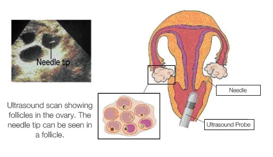Follicular Study